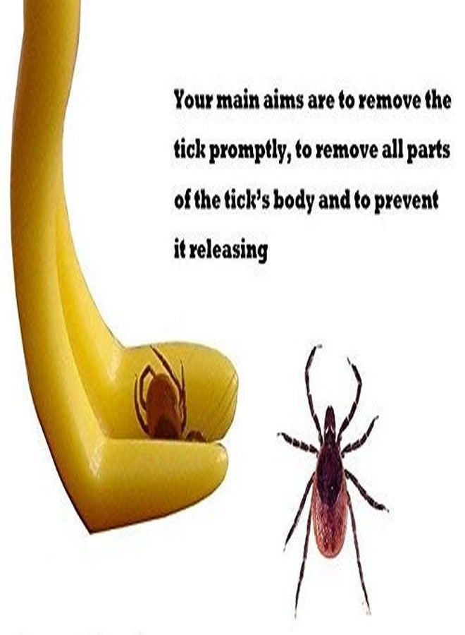 سايج سكوير ملقط سيج سكوير لإزالة عث القراد للعناية الصحية بالكلاب والقطط (عشوائي) - Image 4